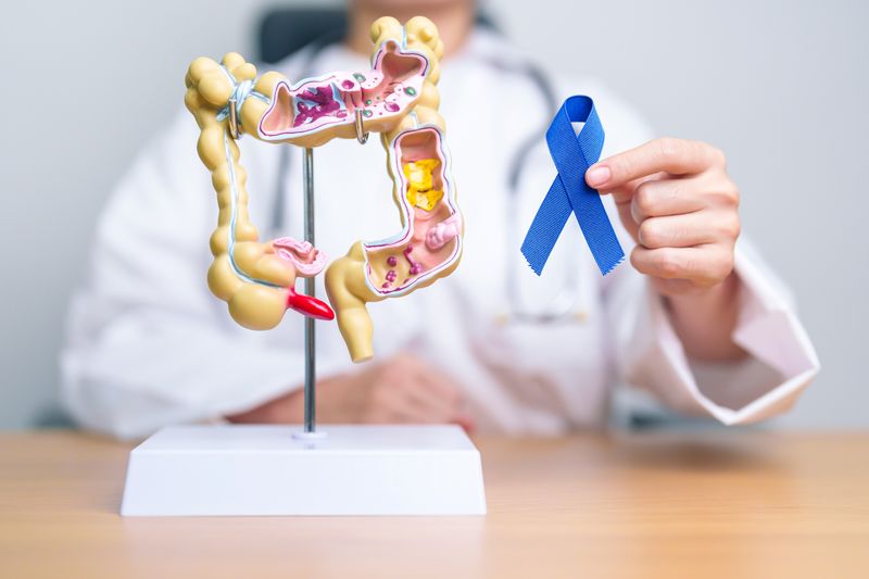 Doctor holding Blue ribbon with human Colon anatomy model.