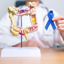 Doctor holding Blue ribbon with human Colon anatomy model.