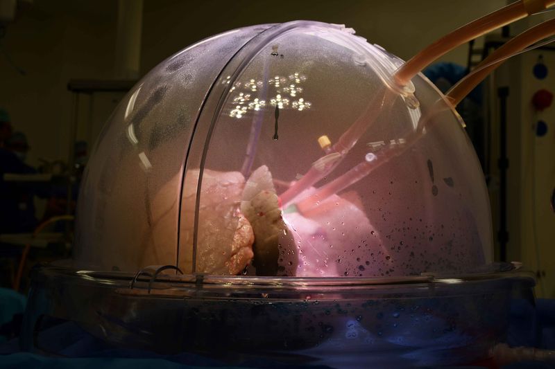 The lung in box, in a very dramatic lighting. 