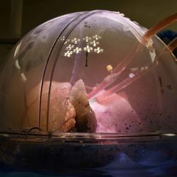 The lung in box, in a very dramatic lighting. 