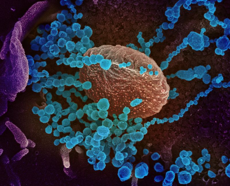 A scanning electron microscope image showing SARS-CoV-2 (round blue objects) emerging from the surface of cells cultured in the lab. 
