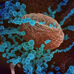 A scanning electron microscope image showing SARS-CoV-2 (round blue objects) emerging from the surface of cells cultured in the lab. 