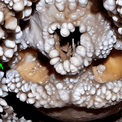 A skull embedded in a cave and covered in "cave popcorn".