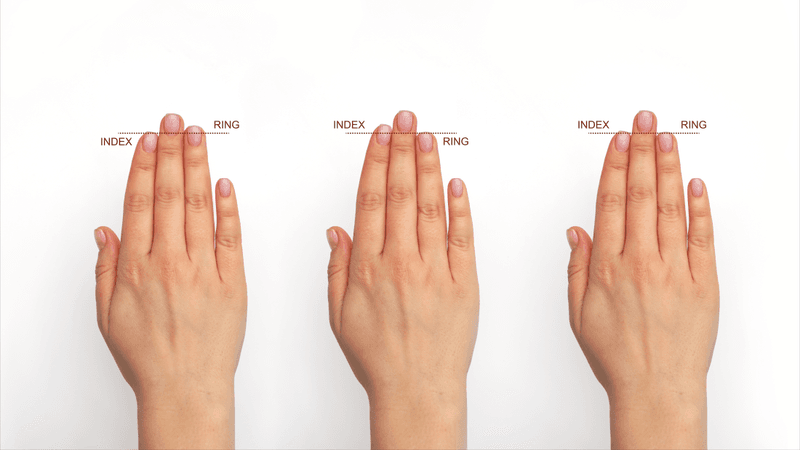 three diagrams showing ring finger longer than second digit, second digit longer than ring finger, and ring finger and second digit equal lengths