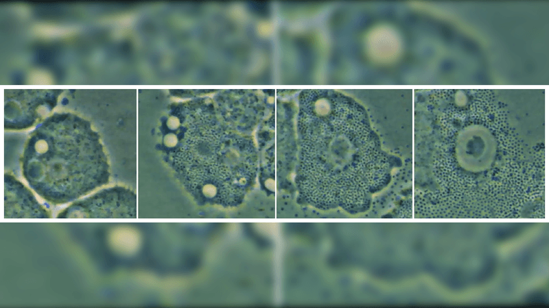 screenshot from a video of mimiviruses infecting acanthamoeba