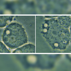 screenshot from a video of mimiviruses infecting acanthamoeba